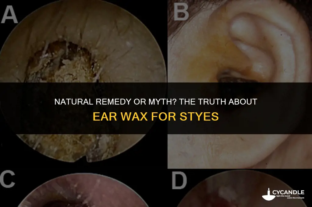 does ear wax work for styes
