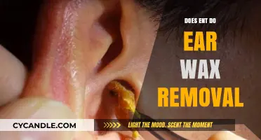 ENT Specialists and Ear Wax Removal: What You Need to Know