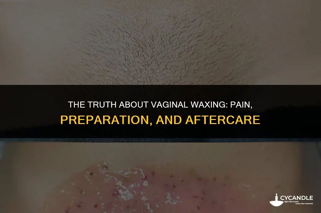 does getting your vag waxed hurt