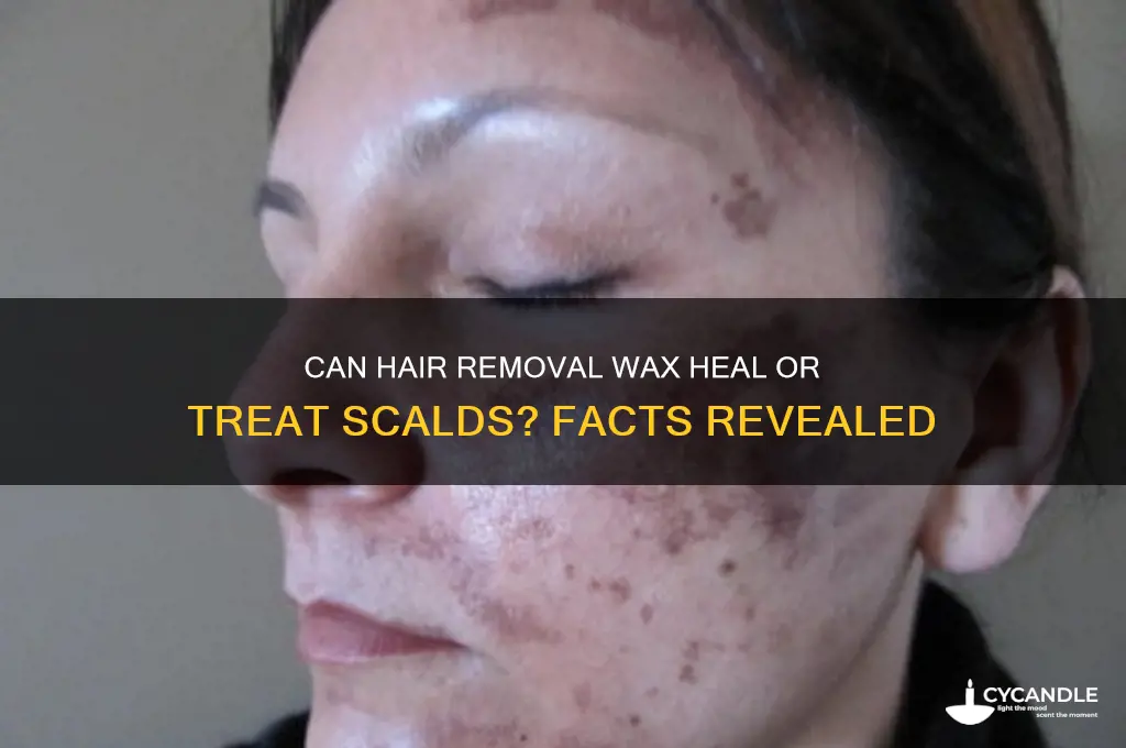 does hair removal wax work on scald