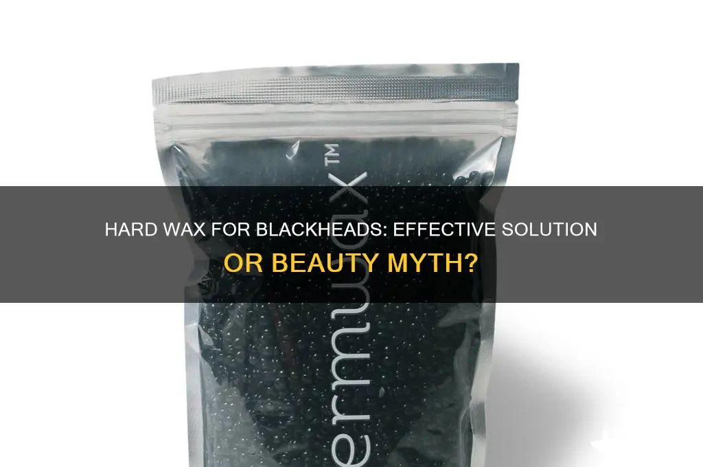 does hard wax remove blackheads