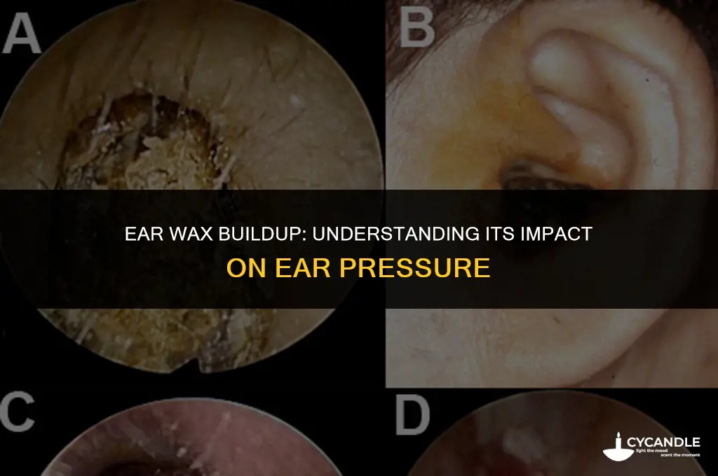 does having too much ear wax cause pressure