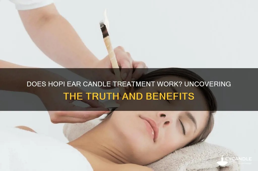 does hopi ear candle treatment work