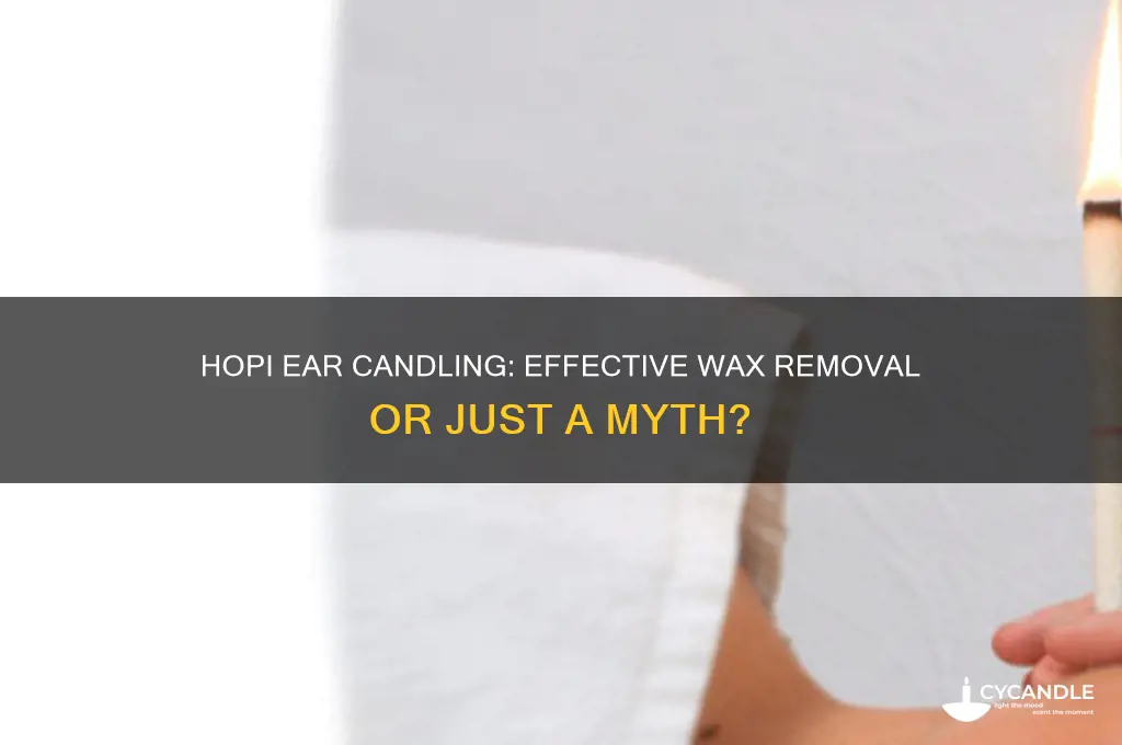 does hopi ear candling remove wax