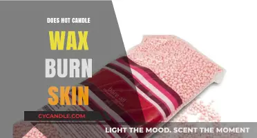Hot Candle Wax Burns: Skin Safety Tips and First Aid