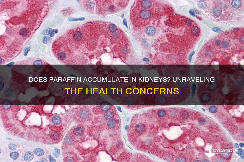 does paraffin accumulate in your kidneys