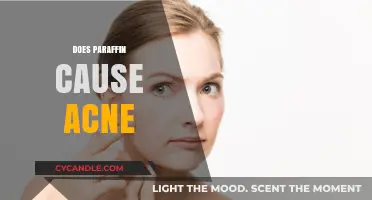 Does Paraffin Cause Acne? Uncovering the Truth Behind the Myth