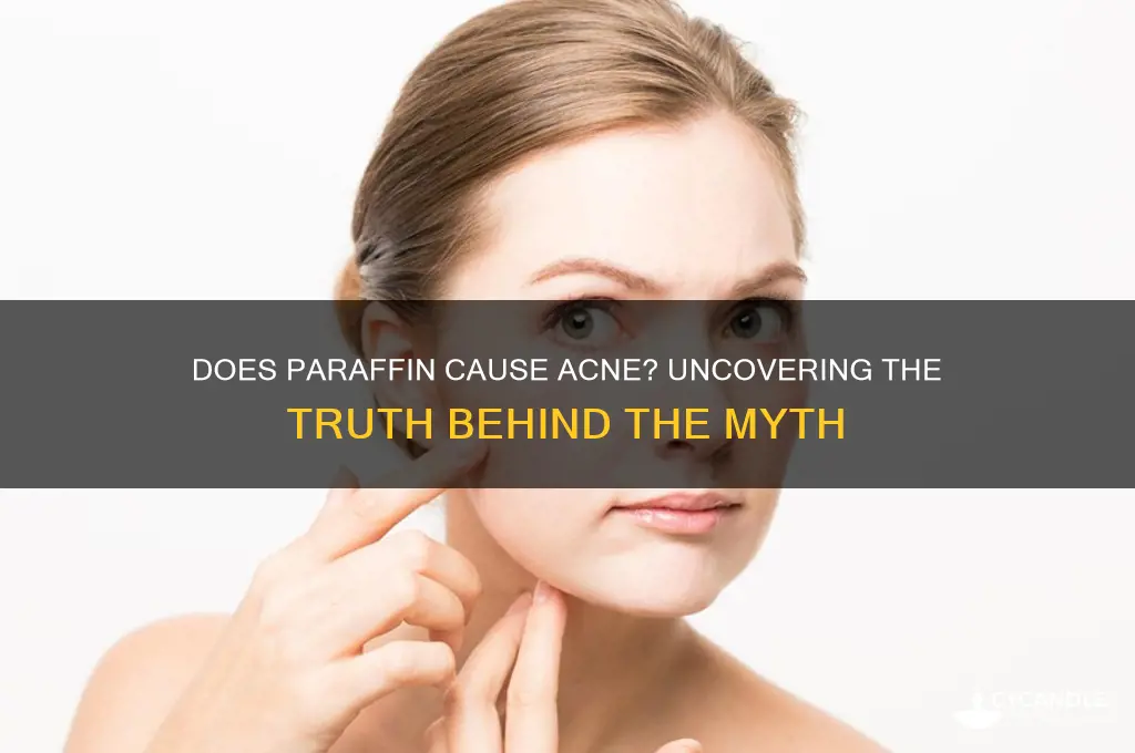 does paraffin cause acne