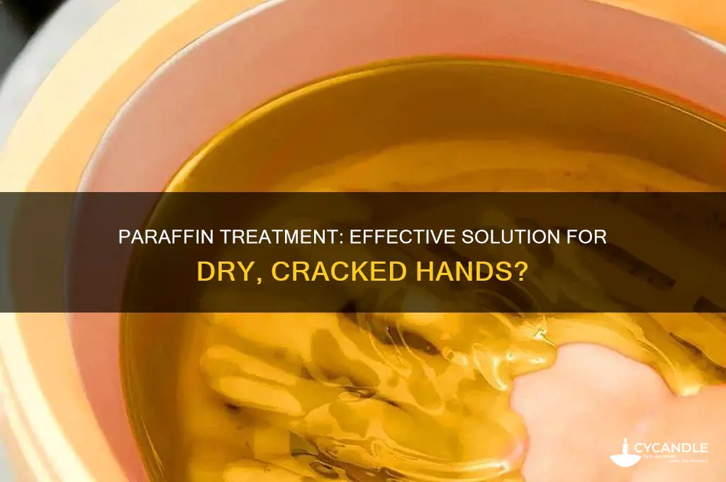 does paraffin help dry hands