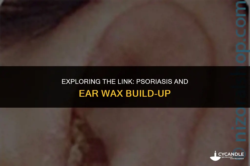 does psoriasis cause ear wax build up