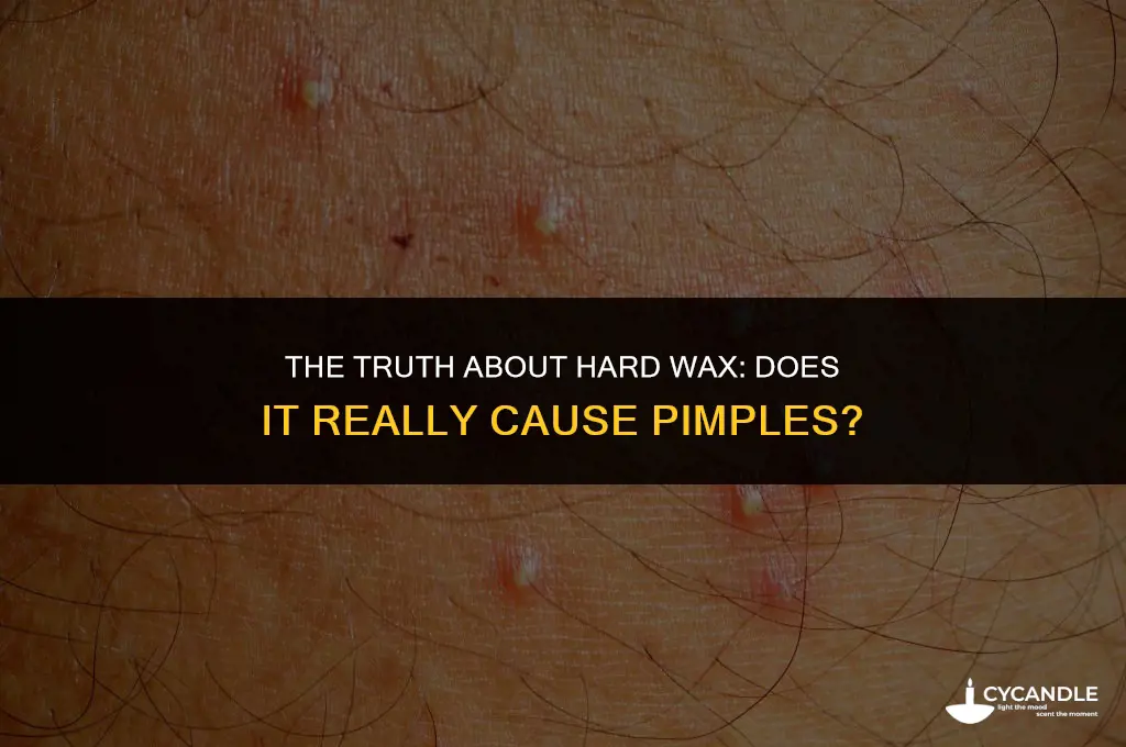 does using hard wax on face cause pimples