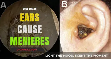 Ear Wax Buildup: A Potential Trigger for Meniere's Disease?
