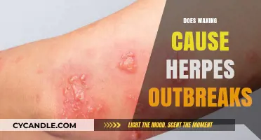 Unveiling the Truth: Waxing and Herpes Outbreak Connection