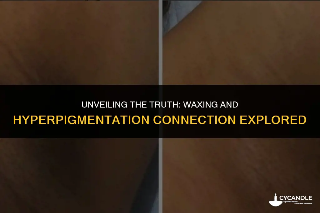 does waxing cause hyperpigmentation