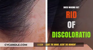 Waxing Wonders: Can It Banish Skin Discoloration?