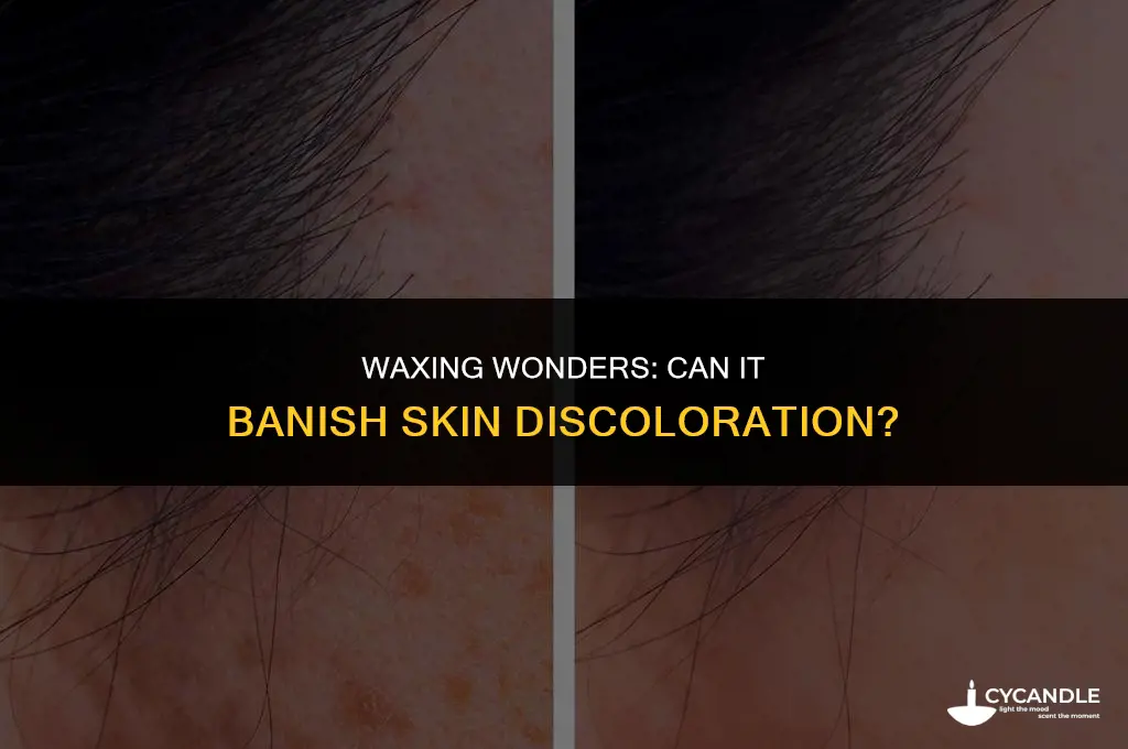does waxing get rid of discoloration