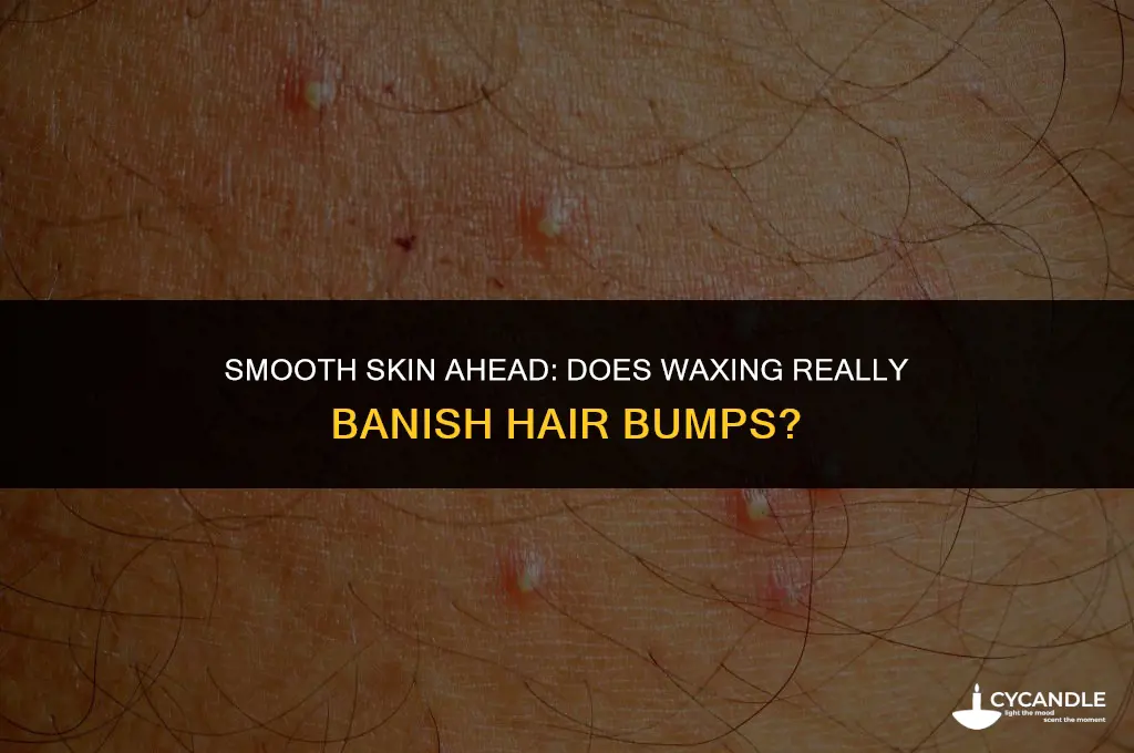 does waxing get rid of hair bumps