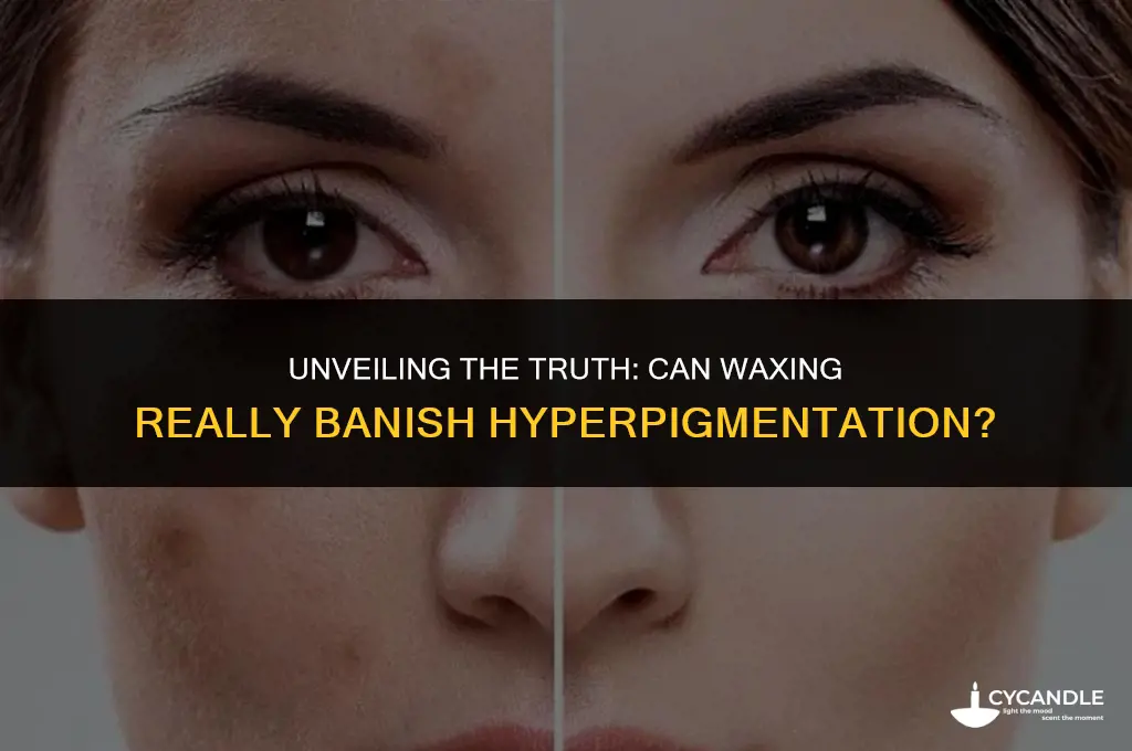 does waxing get rid of hyperpigmentation