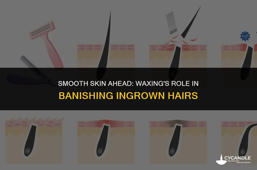 does waxing get rid of ingrown hairs