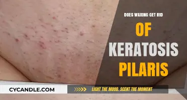 Smooth Skin Ahead: Can Waxing Tackle Keratosis Pilaris?
