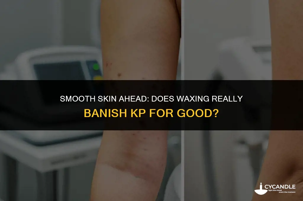 does waxing get rid of kp