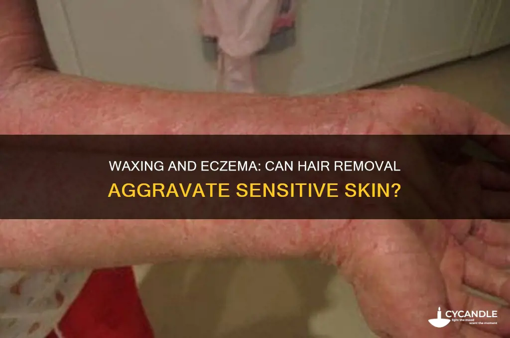 does waxing make eczema worse