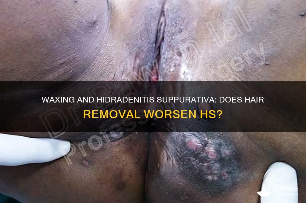 does waxing make hs worse
