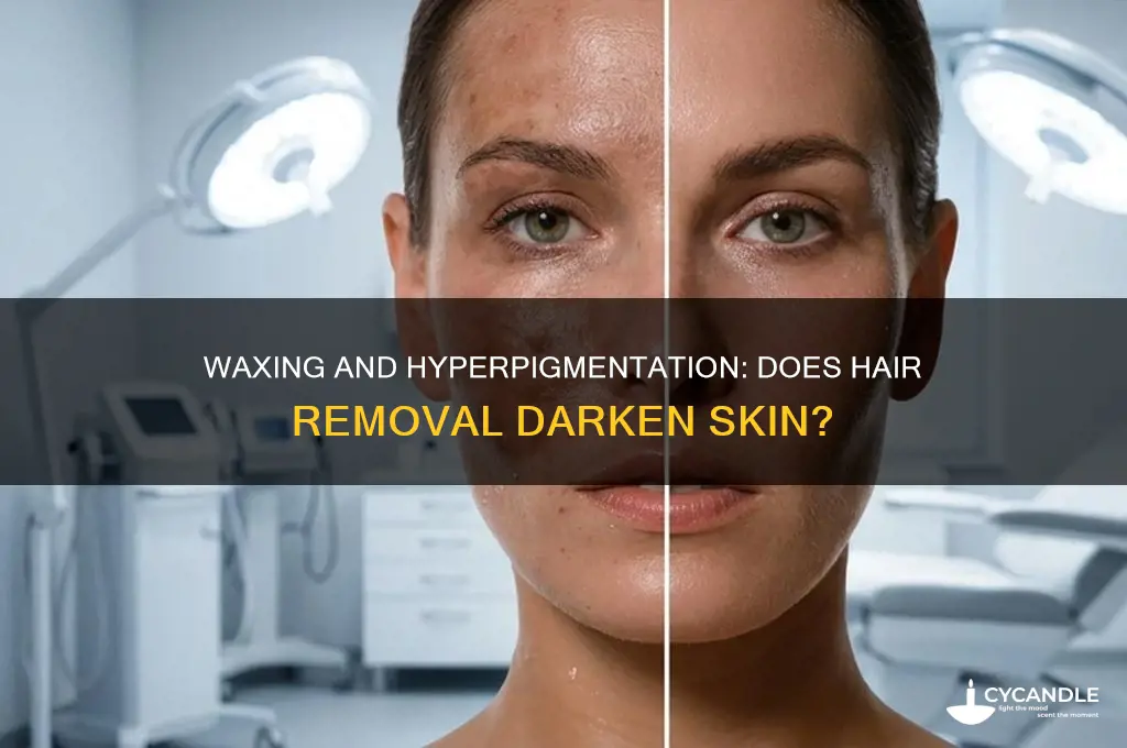 does waxing make hyperpigmentation worse
