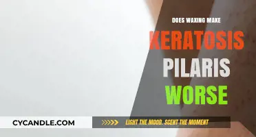 Waxing and Keratosis Pilaris: Does Hair Removal Worsen Skin Bumps?