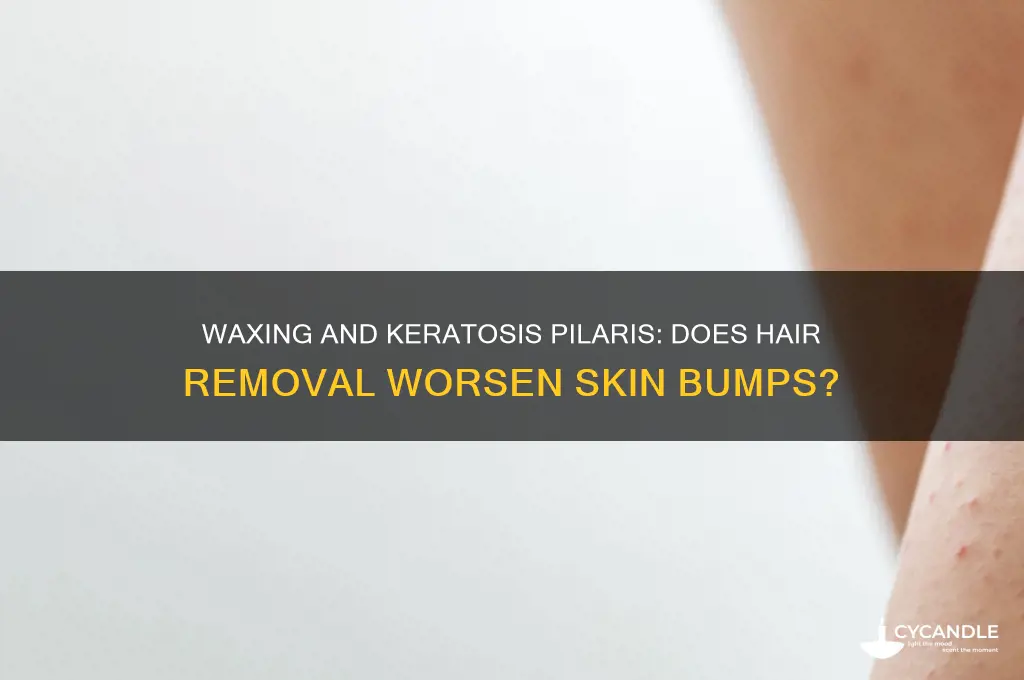 does waxing make keratosis pilaris worse