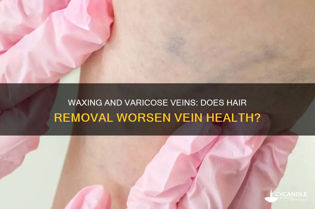 does waxing make varicose veins worse