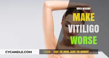 Waxing and Vitiligo: Understanding the Impact on Skin Depigmentation