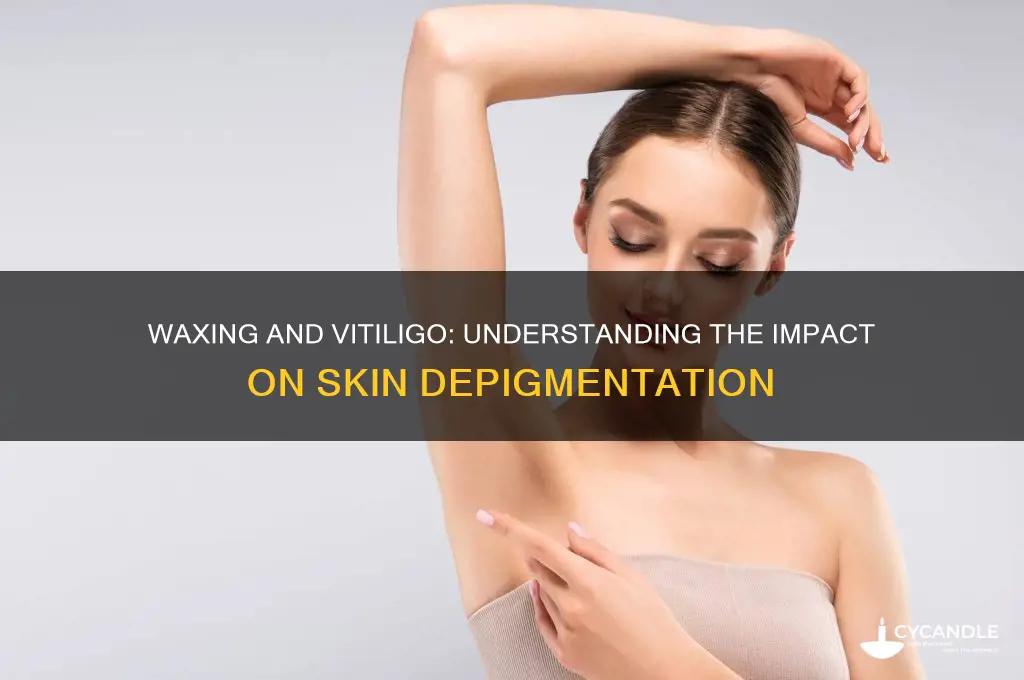 does waxing make vitiligo worse