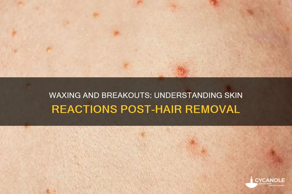 does waxing make you break out