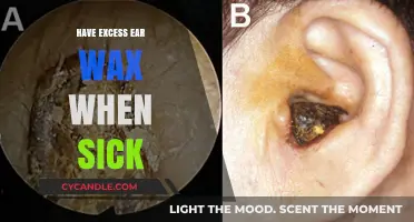 Ear Wax Buildup: A Surprising Symptom of Illness You Shouldn't Ignore