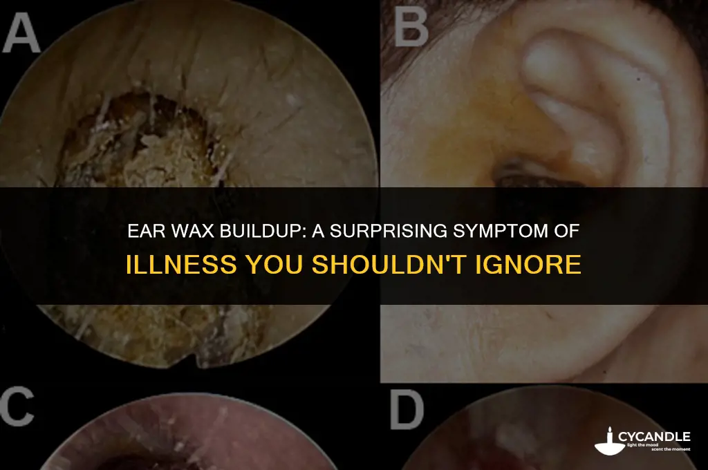 have excess ear wax when sick