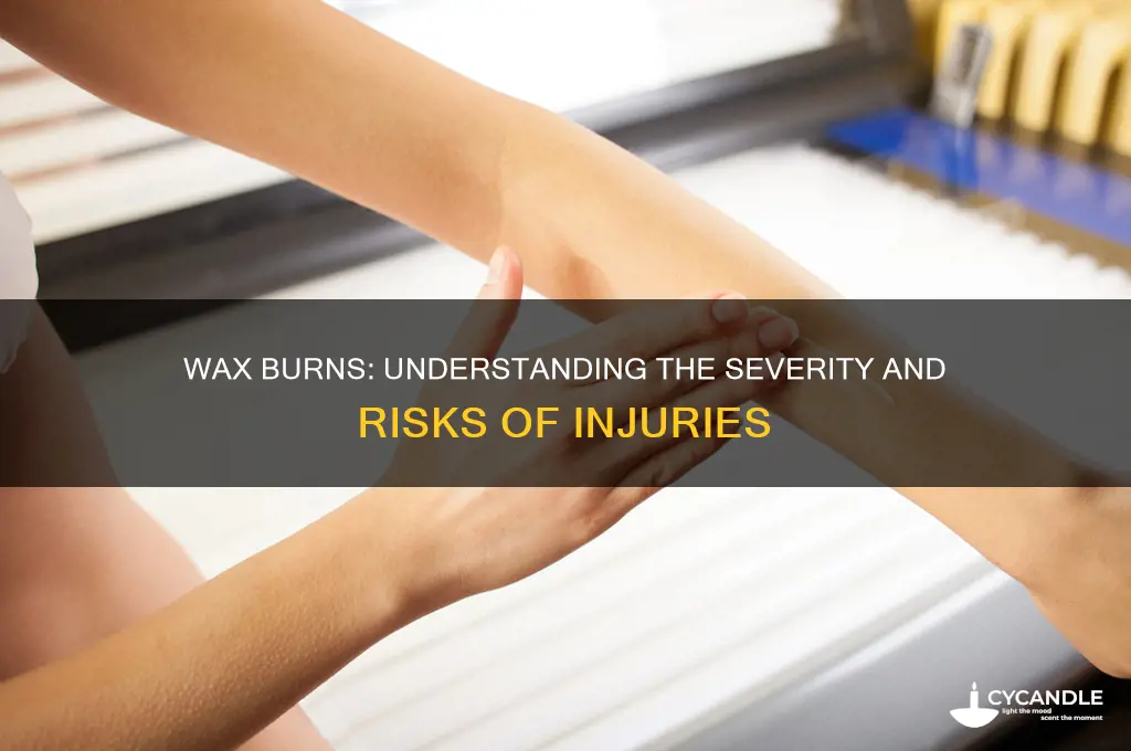 how badly can wax burn you