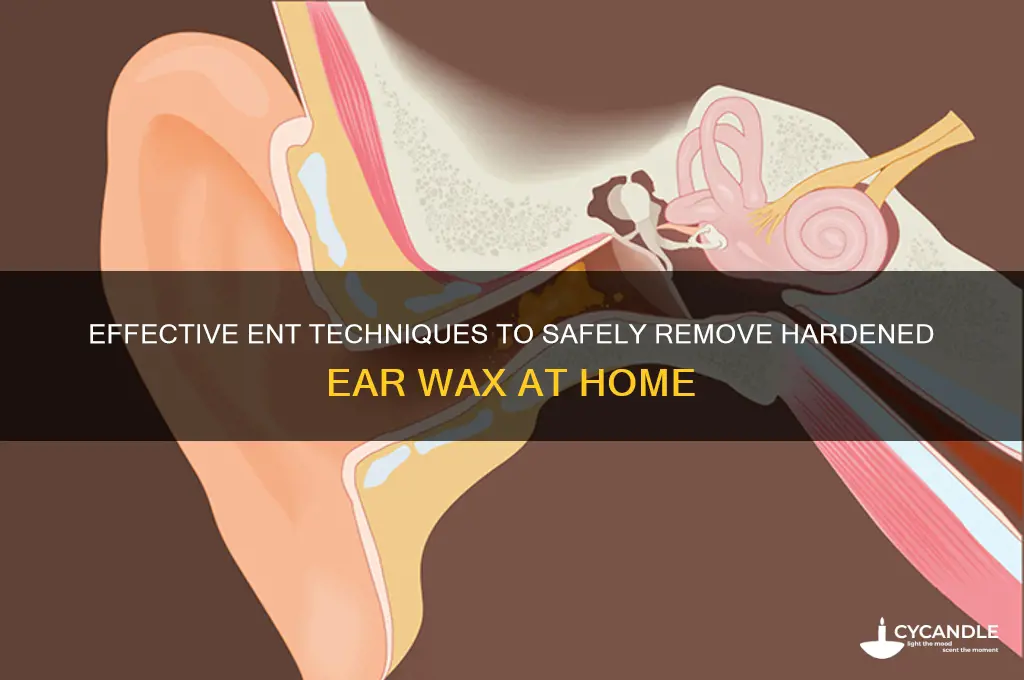 how can ent remove hardened wax from ears