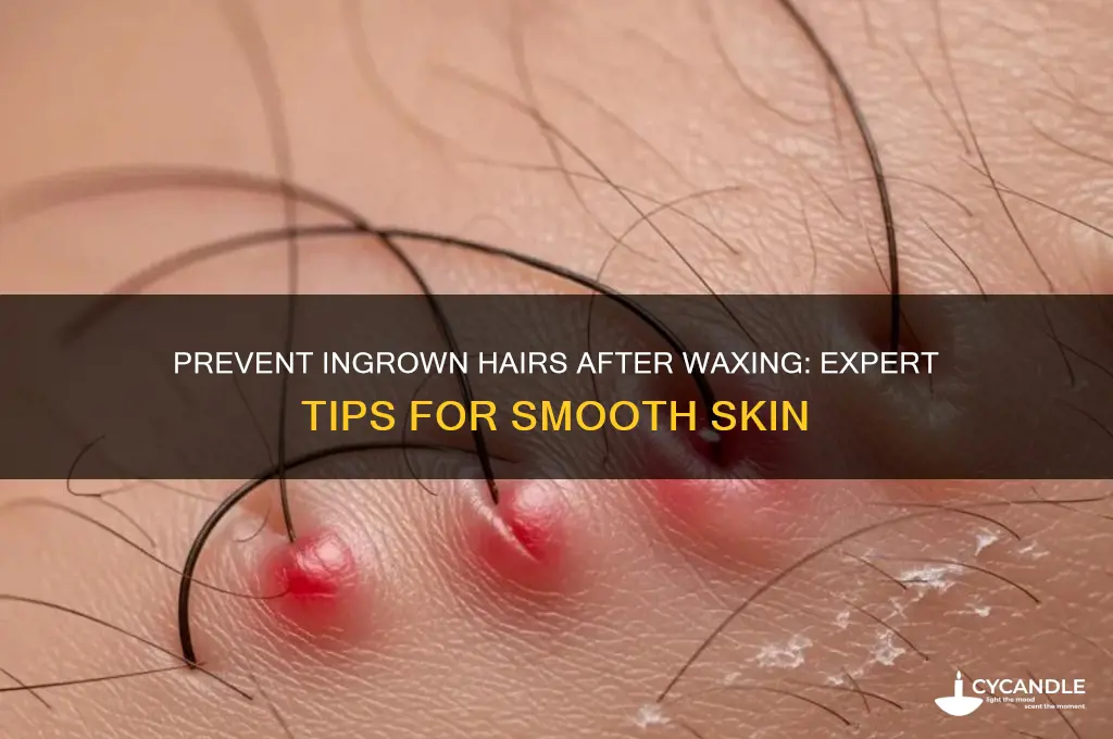 how can i prevent ingrown hairs after waxing