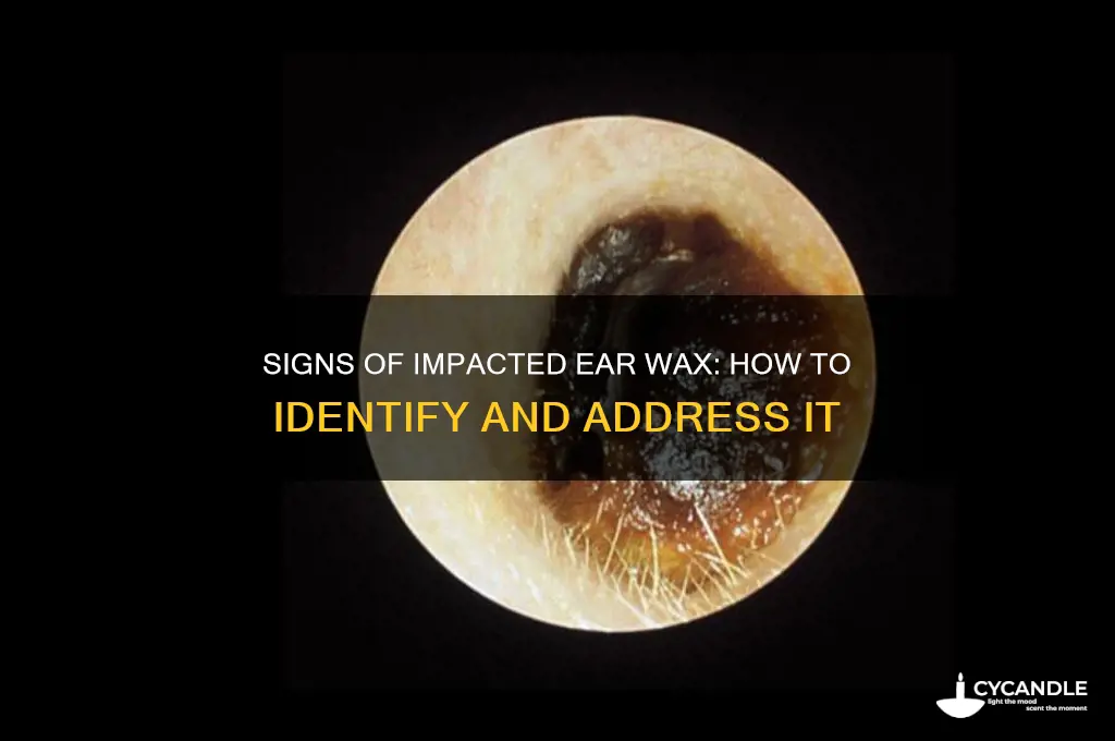 how can you tell if you have impacted ear wax
