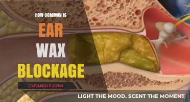 Unclogging the Truth: How Common is Ear Wax Blockage?