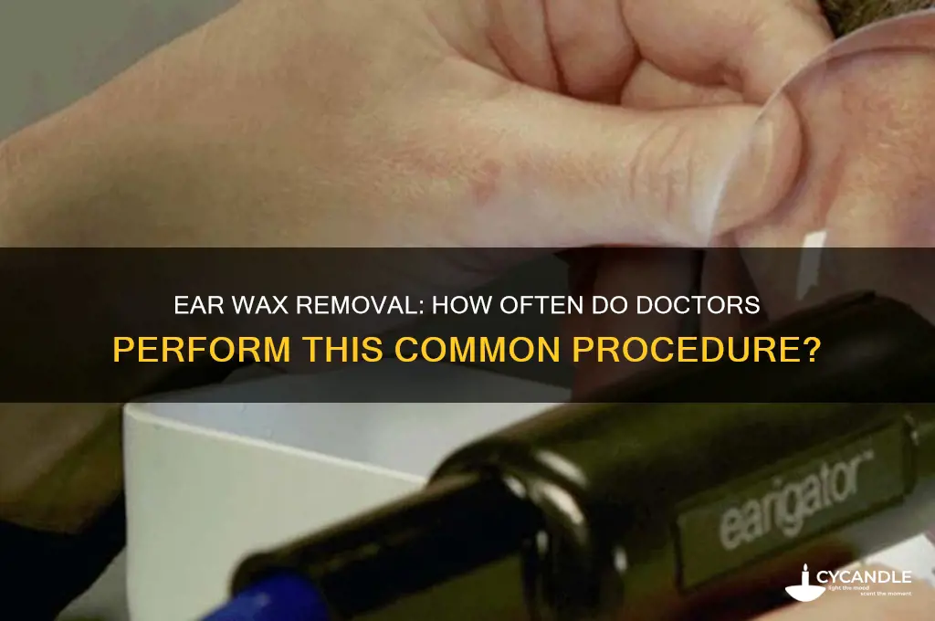 how common is ear wax removal in a dotors office