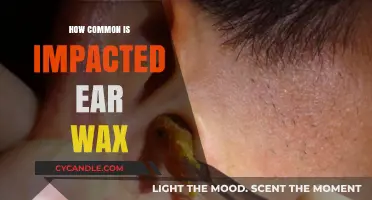 The Surprising Prevalence of Impacted Ear Wax: What You Need to Know