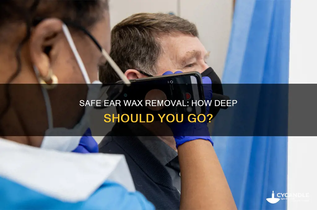 how deep to go ear wax remover