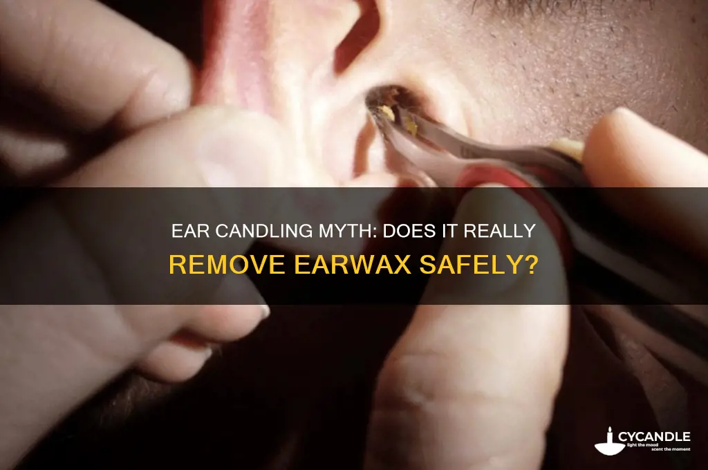 how do ear candles get wax out