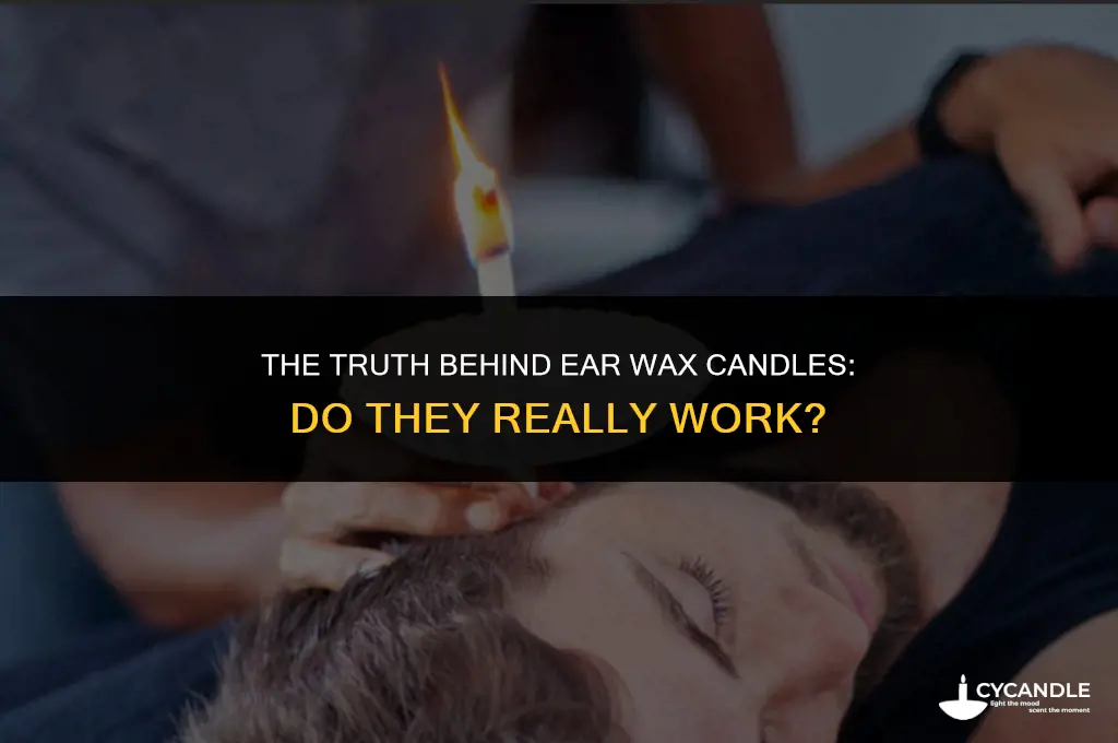 how do ear wax candles work