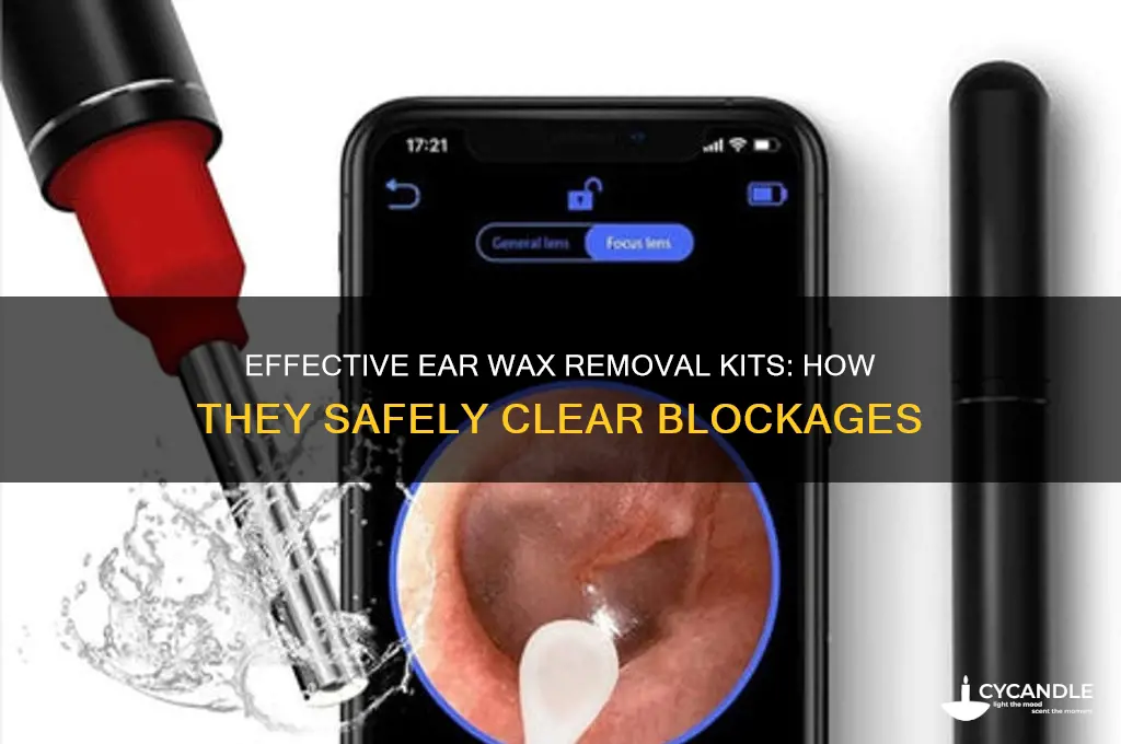 how do ear wax removal kits work