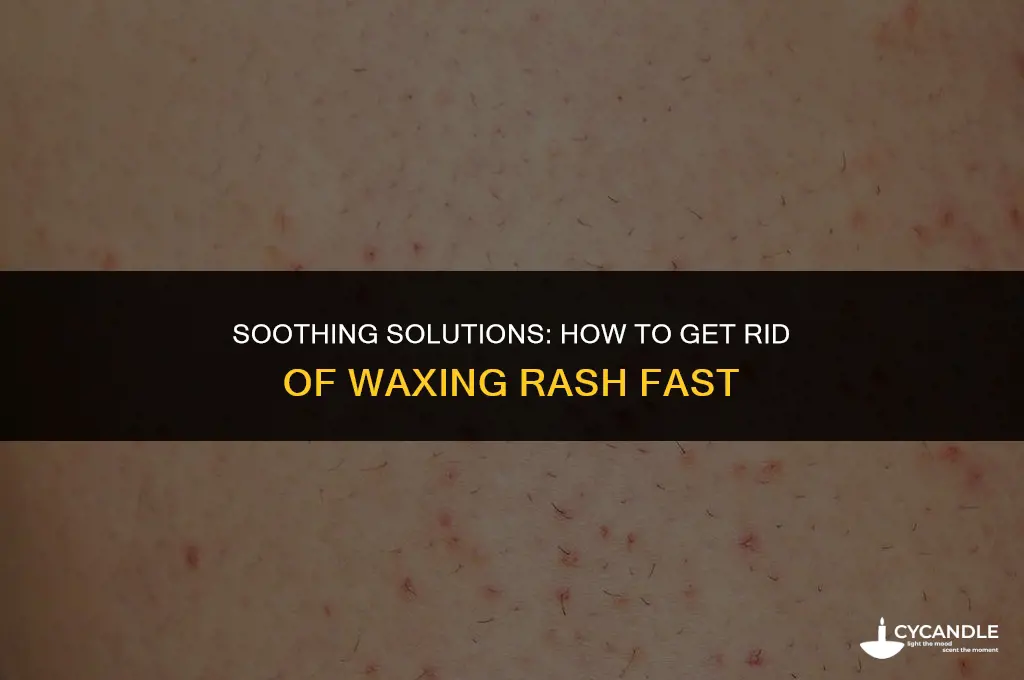 how do i get rid of waxing rash