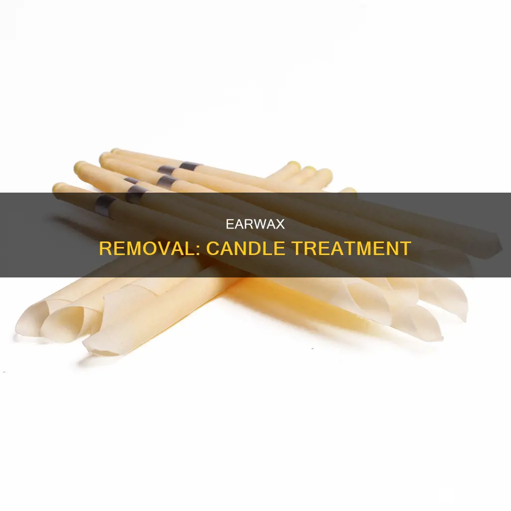 how do i remove earwax with a candle