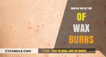 Effective Remedies to Soothe and Heal Wax Burns Quickly